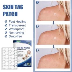 Best Offer Discount 50% Treating Acne Patch Removing Wart Moles And Skin Tags Pain-free White Herbal Essence