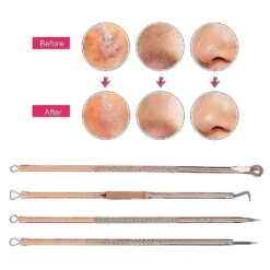 4pcs/set Acne Remover Tool Stainless Steel Rose Gold Double Head Needles Blackhead Extractor