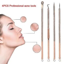 4pcs/set Acne Remover Tool Stainless Steel Rose Gold Double Head Needles Blackhead Extractor -Cosmetics Promotion Store 1527214620 max