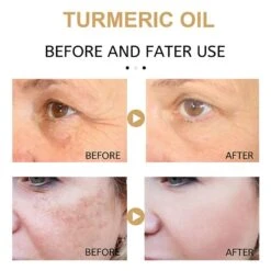 Facial Serum - Turmeric Essence For Correcting Dark Spots And Moisturizing (30ml)