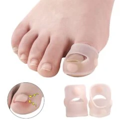Silicone Ingrown Nail Curling Nail Correction Nail Toe Correction Device -Cosmetics Promotion Store 243623101 max