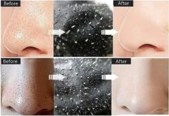 Mineral Mud Blackhead Exfoliating Mask Acne Treatment 20 Pieces -Cosmetics Promotion Store 293525655 max