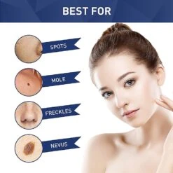 Mole Tag Wart Remover Antibacterial Solution Remove Fleshy Particle Cream 6 Mole Tag Wart Remover Antibacterial Solution Remove Fleshy Particle Cream -Cosmetics Promotion Store 304805450 max