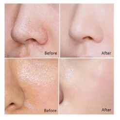 Handmade Rice Soap Thai Jasmine Rice Collagen Vitamin Skin Whitening Bathing Oil Control Whitening Moisturizing Tools 9 Handmade Rice Soap Thai Jasmine Rice Collagen Vitamin Skin Whitening Bathing Oil Control Whitening Moisturizing Tools -Cosmetics Promotion Store 466020551 max