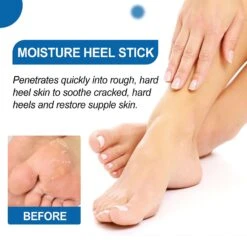 Foot Moisturizing Repair Cream Balancing Skin Moisture Balm For Smooth & Moisturizing Skin