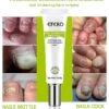 3pcs Efero Nail Anti Fungal Infection Gel Treatment Hand Foot Cream Toenail Remover