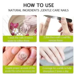 Efero Nail Anti Fungal Infection Gel Treatment Hand Foot Cream Toenail Remover 9 Efero Nail Anti Fungal Infection Gel Treatment Hand Foot Cream Toenail Remover -Cosmetics Promotion Store 972546449 max 1