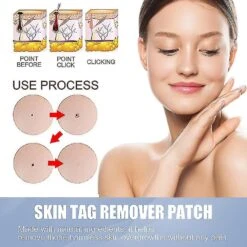 Warts & Moles Treat Patch Fast Healing Dark Moles Remover Painless Skin Nevus Removal Patch 3pcs -Cosmetics Promotion Store 974221530 max