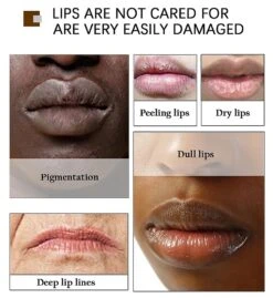 1-3pcs Removes Dark Lip Lips Pink Fresh Fast Lightening Bleaching Cream Balm Treatment 9 1-3pcs Removes Dark Lip Lips Pink Fresh Fast Lightening Bleaching Cream Balm Treatment -Cosmetics Promotion Store 995028386 max